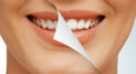 Private: Regaining Your Confidence through Teeth Whitening
