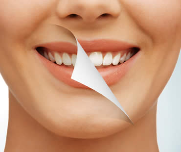 Private: Regaining Your Confidence through Teeth Whitening